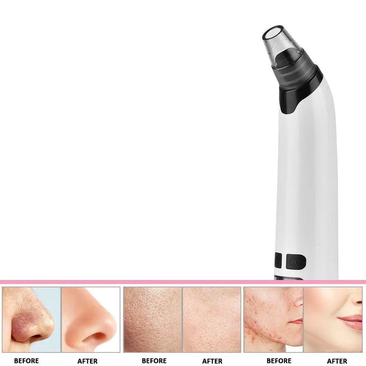 Well DudesElectric Blackhead RemoverOur Electric Blackhead Remover is the perfect solution for men looking to achieve clearer, smoother skin. This advanced grooming tool is designed to remove stubborn Well DudesElectric Blackhead Remover